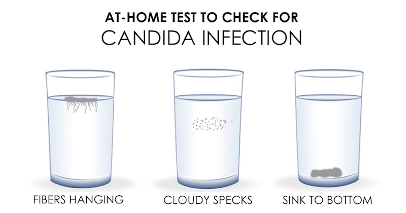 candida-infection-test