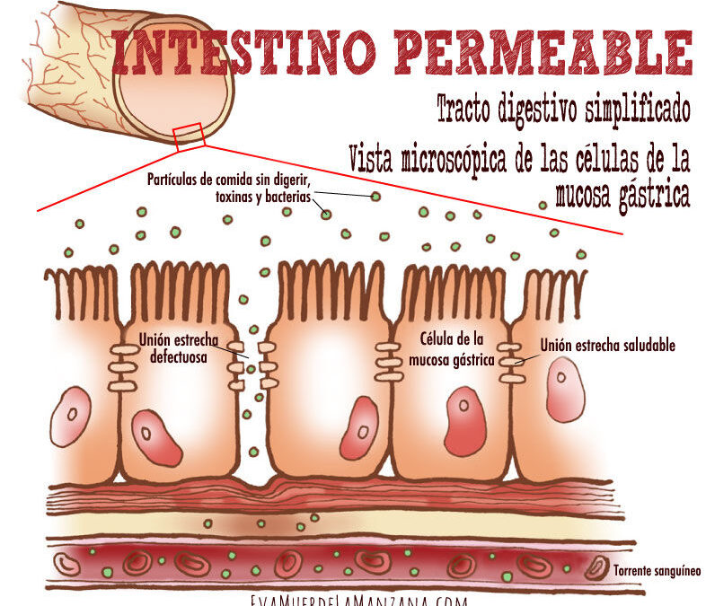 diagrama_intestino_permeable